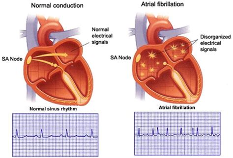 Pin On Medical Conditions