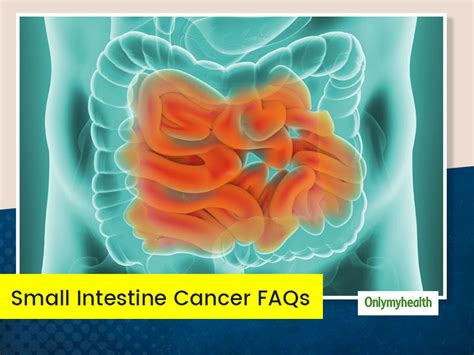 small intestine cancer know cause symptoms and treatment of this