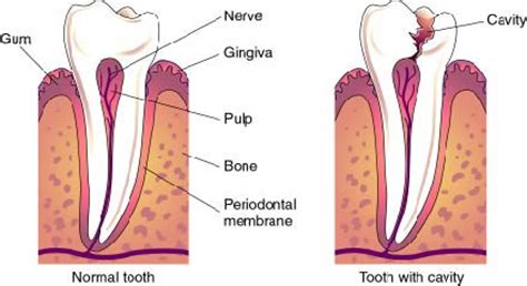 cavity   doesnt  hurt wake dental wellness