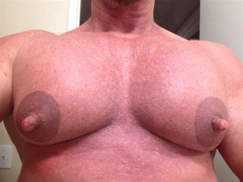 【画像】女性化乳房になった男達。これは地獄だわ ポッカキット