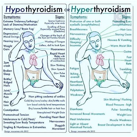 great little comparison of hyperthyroidism and hypothyroidism