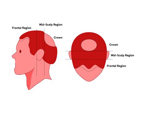 regions   scalp