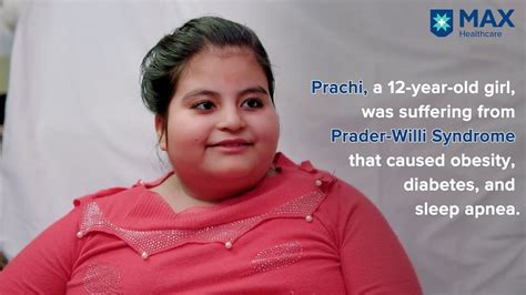 Bariatric Surgery Success Story 12 Year Old Battles Prader Willi