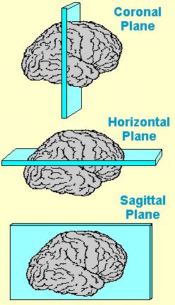 sagittal section   brain