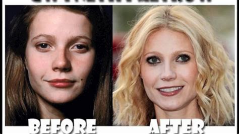 celebrity plastic surgery pictures    part  youtube