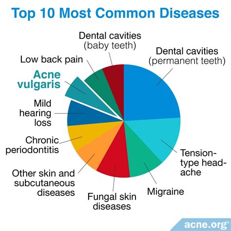 acne  disease acneorg