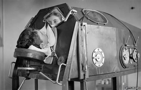 in pictures the history of polio bbc news