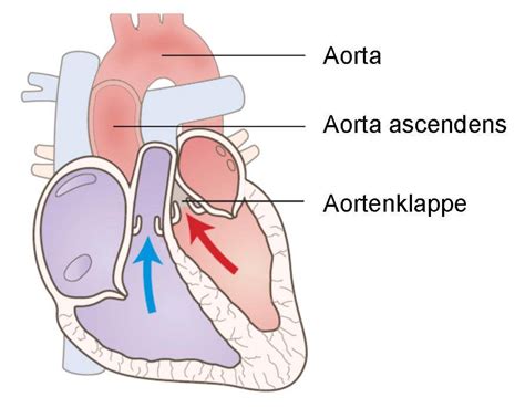 aortenaneurysma definition therapie und fakten operationen