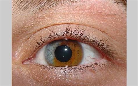olhos vermelhos naturais albino pesquisa google olhos vermelhos naturais olhos vermelhos