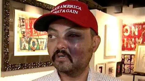 nyc man brutally assaulted by teens for wearing maga hat
