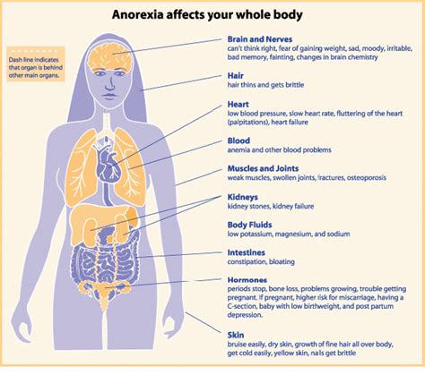 Anorexia Nervosa Physiopedia