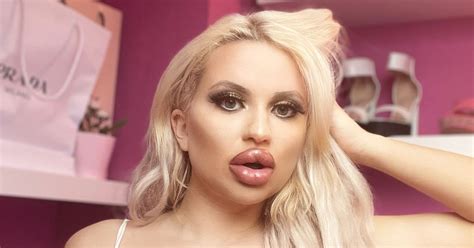Plastic Surgery Addict With 32k Boobs Spends £30 000 To Look Like Bratz