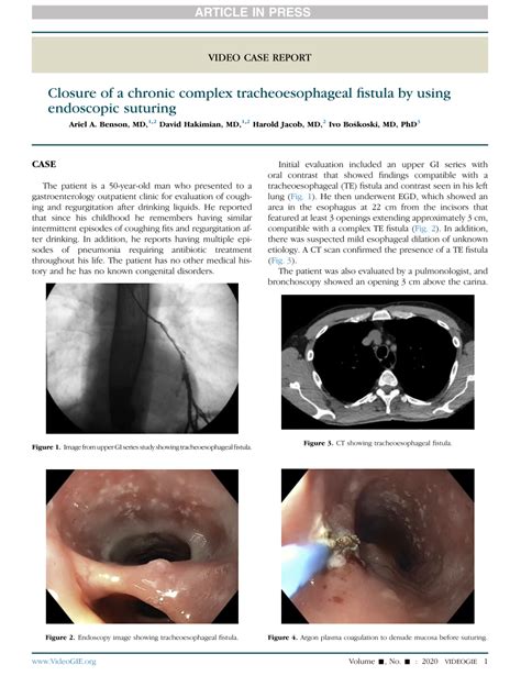 Pdf Closure Of A Chronic Complex Tracheoesophageal Fistula By Using