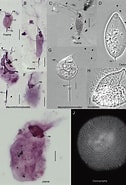 Afbeeldingsresultaten voor "pterocyrtidium Dogieli". Grootte: 126 x 185. Bron: www.researchgate.net