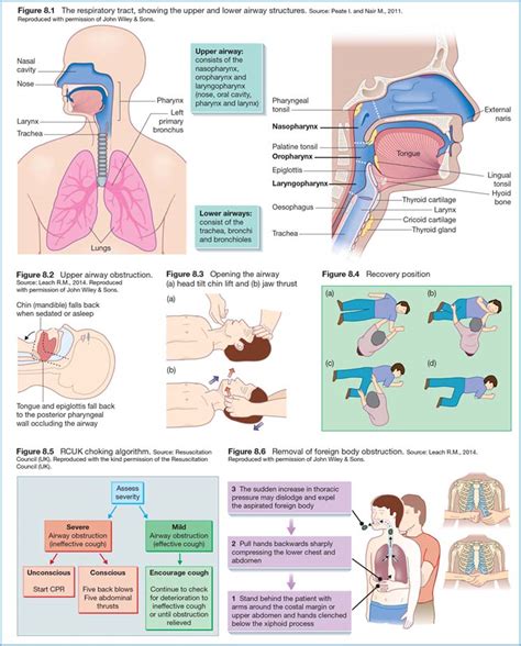 advanced airway management nurse key