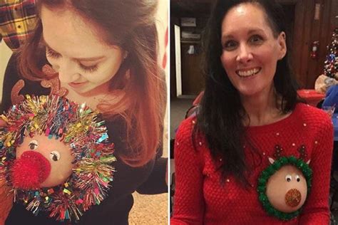 Reindeer Boobs Are Back As Daring Women Try Out The Titillating Festive