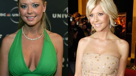 Stars Who Had Implants Removed Slideshow Fox News