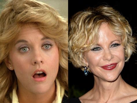 Meg Ryan’s Before And After Plastic Surgery Photos Should