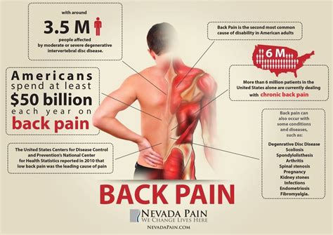 pain infographic  pain   million peopl flickr