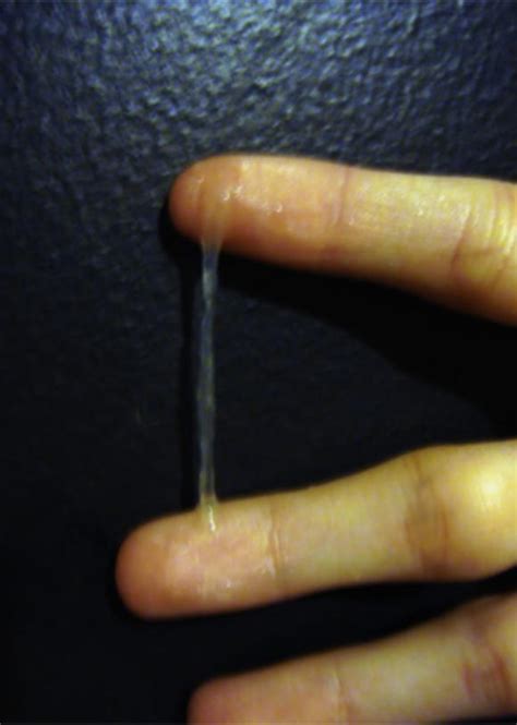 What Cervical Mucus Looks Like Through Your Cycle Photo Gallery
