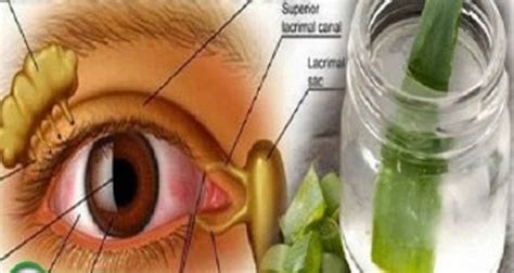 Improve Your Eyesight With This Magical Remedy
