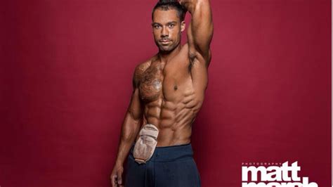 Male Bodybuilding Model Shows Off His Colostomy Bag