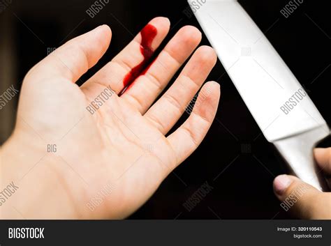 finger cut bleeding image photo  trial bigstock