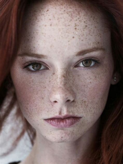 Yesgingerfriend “klasse Sommersprossen ” Freckles Girl Beautiful