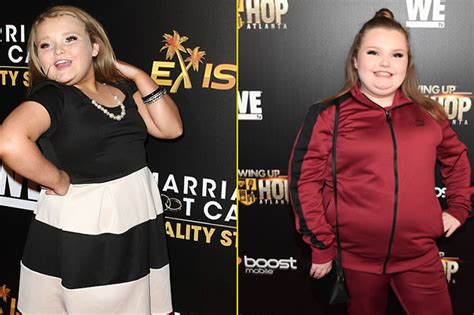 Did These Stars Undergo Gastric Bypass Surgery See Their