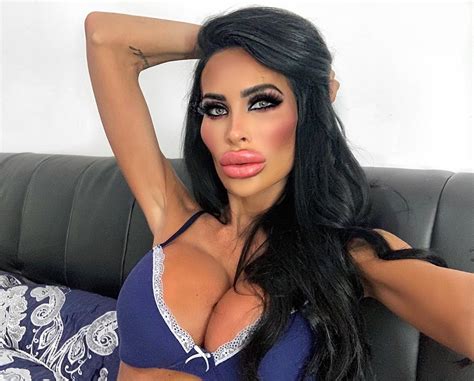 ‘plastic Barbie’ Junkie Spends £55 000 On Surgery Admits