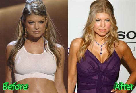 Did Fergie Get A Boob Job Porn Images Full Hd