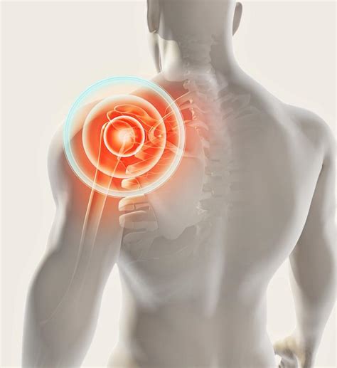 shoulder pain steven grossinger  pain management