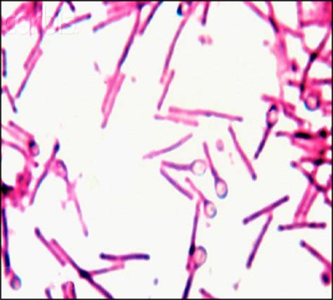 Clostridium Tetani ~ Everything You Need To Know With Photos Videos