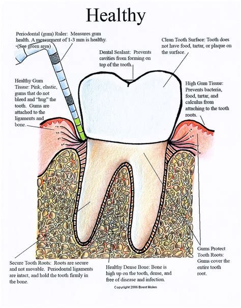 omni dental group periodontal disease