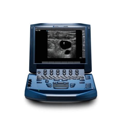 sonosite micromaxx portable ultrasound system hiliex