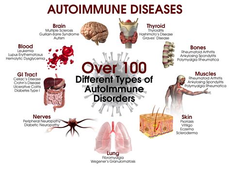 autoimmune elimination program autoimmune disease autoimmune disorder autoimmune