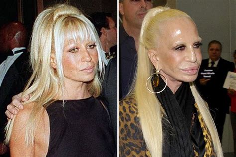Plastic Surgery Donatella Versace Goddess Of Glam Bad Celebrity