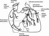Stent Cardiac Bmj Acute Tranexamic Acid sketch template