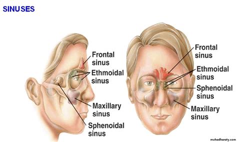 maxillary sinus disease pptx dofa muhadharaty