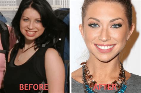 Celebrity Before And After Plastic Surgery Shock