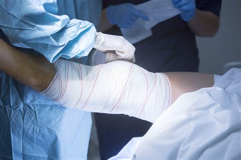 Treating A Meniscus Tear When Is Knee Surgery Your Best