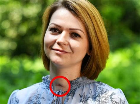 ex spy s poisoned daughter yulia skripal recovering with neck scar