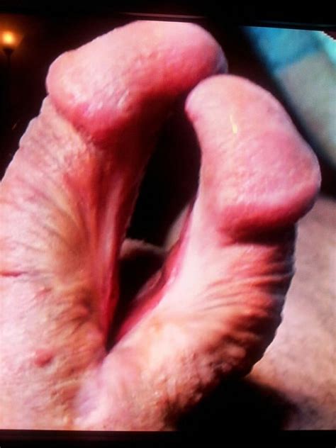 extreme modification of the penis 85 pics xhamster