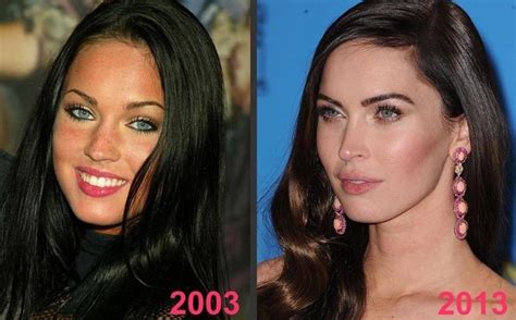 megan fox before and after plastic surgery a tale of evolution asean tv