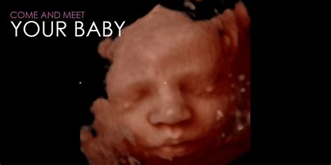 home  bellies ultrasound ddd dhd pregnancy spa
