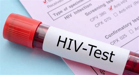 6 433 cases of hiv among ofws as 22 increase recorded in