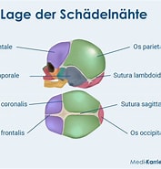 Bildergebnis für Erweiterung der Schädelnähte Bei All Mit Meningeosis Leucaemica. Größe: 177 x 185. Quelle: www.medi-karriere.de