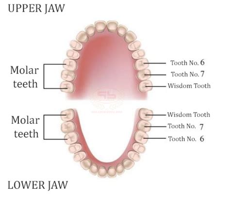 molar tooth   removed    painful