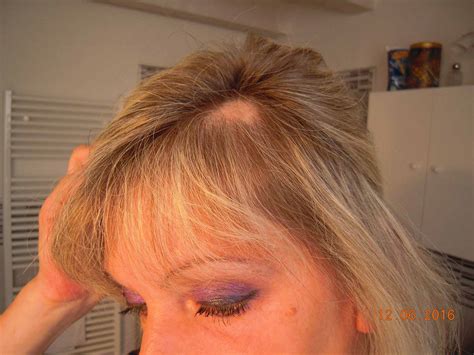 Dallo stress al cambio di stagione · stress · cambio di stagione · inquinamento ambientale · trattamenti cosmetici aggressivi . Soluzione per Alopecia Areata e Perdita capelli - Ricchezza Naturale