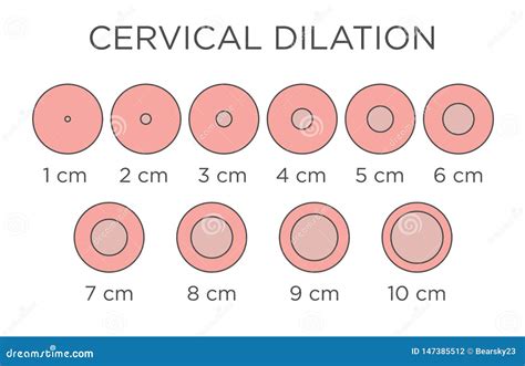 cervial dilation medical illustration chart  centimeters stock